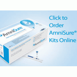 AmniSure® ROM Test - box of 10 tests